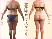 ココア整体 岐阜店(cocoa整体)/最新痩身マシン/脂肪燃焼リンパ