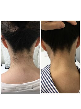 ミース 熊本店/うなじ矯正◆ビフォーアフター
