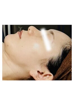 メディカルサロン かとれあ/ダクトピール