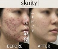 スキニティ 池袋(sknity)