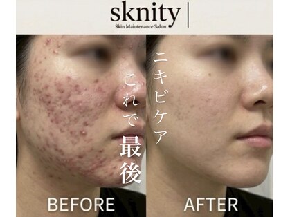 スキニティ 池袋(sknity)の写真