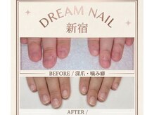 ドリームネイル 新宿(Dream Nail)
