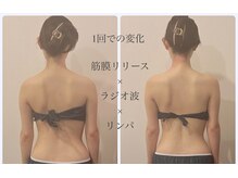 ガーレット(Garlett)の雰囲気(美背中作り×肩首凝り改善◎(筋膜リリース×ラジオ波×リンパ))