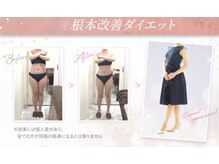 えすてさろん ケイアンドエフ(k&f)/K＆F成功ダイエットでキレイ痩せ