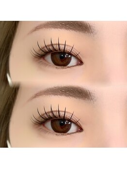 リベルテ(liberte)/リフエク100