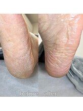 フットミー(foot mii)/