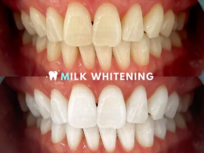 ミルクホワイトニング 久留米店(Milkホワイトニング)の写真