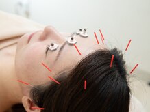 本厚木鍼灸整骨院/疲れやすい方に