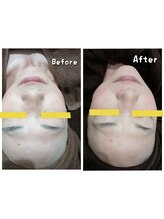 プロジェクトサン ムーンベル(PROjECTSuN Moonbell)/フェイシャル