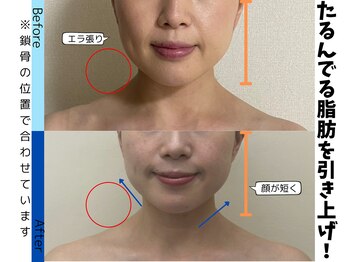 お顔の研究所/ビフォーアフター写真♪