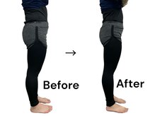 ブライトプラス(BRIGHT+)/ダイエットコース