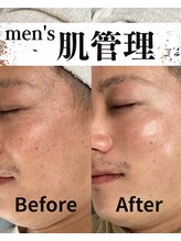 整体院ユールーム 下松店(YOUROOM)/【men's肌管理】