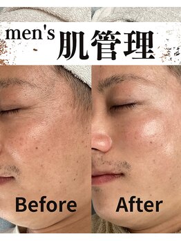 整体院ユールーム 下松店(YOUROOM)/【men's肌管理】