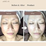 ヒロイントータル(HIRO-IN Tatal)