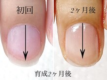 トゥインクリーネイルサロン(Twinkly Nail Salon)/【地爪育成】1回お試し