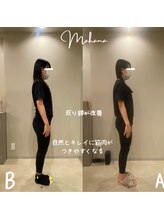 マハナ(mahana)/反り腰、ポッコリお腹改善