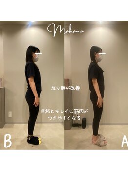 マハナ(mahana)/反り腰、ポッコリお腹改善