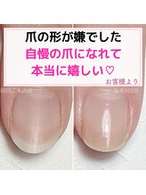 ミミ(mimi)/爪のお悩み解消しましょう