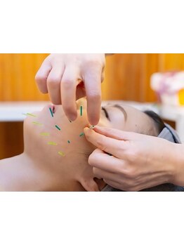 鍼灸施術を受けたい