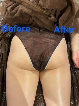 シエル 春日部店(Ciel)/ビフォーアフター