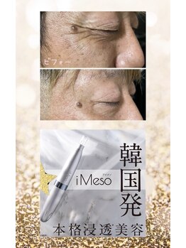 ビューティースパ/韓国発アイメソ/シワたるみケア