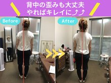 京都中丸整体カイロプラクティック/背骨の歪み
