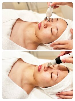 ポーラ ザ ビューティ 岸和田駅前店(POLA THE BEAUTY)/人気マシンオプション