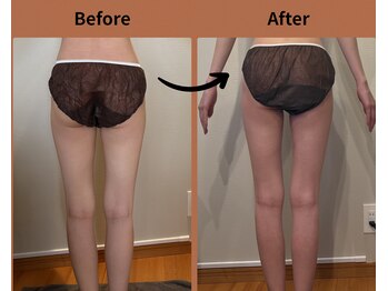 テン エイト(10 8)/2回の結果ヒップ&脚