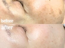 サンティエ(Santie)の雰囲気（目に見える変化に感動！最新フェイシャルメニュー取扱開始）