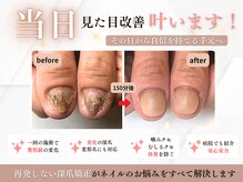 ブルームーンネイルズ(BLOOMOON.nails)