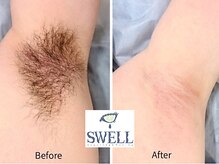 スウェル 京都寺町御池店(SWELL)の雰囲気（【シュガーリング脱毛×光脱毛】即ツル＆長持ち♪メンズ脱毛も◎）