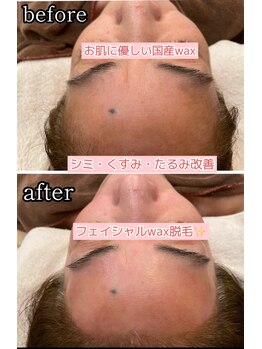 ルノン(LUNON)/国産WAXで産毛脱毛