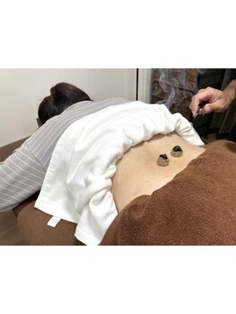 鍼灸施術を受けたい