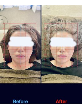 トーラス 整体(TORUS)/むくみ