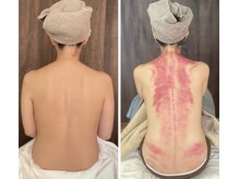 リュクス(Luxe)/初回ビフォーアフター（40代）