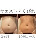 3名様限定【ウエスト腰回りスッキリ体験】くびれ作り90分￥47500→17,000
