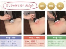 サロン ド オージャス(salon de ojas)の雰囲気（【モニター募集】脂肪撃退マシーン導入キャンペーン♪）