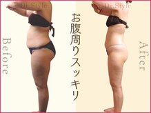 ココア整体 岐阜店(cocoa整体)/最新痩身マシン/脂肪燃焼リンパ