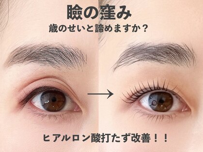 ルチル(rutile)の写真
