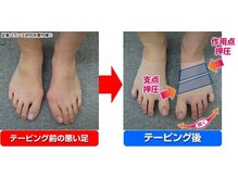 足楽ほんぽ/足の骨格矯正