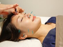 ツボプロ 梅田院/Medicure美顔鍼灸
