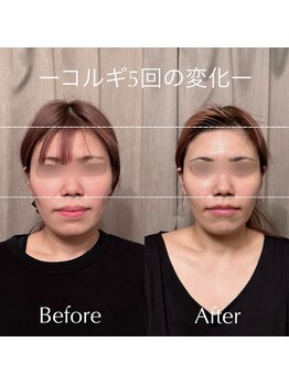 アイミーボーテ(Aime beaute)/《コルギ》