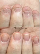 マリーロール 天王寺店(Marie Laure)/自爪育成/深爪矯正/ネイルケア