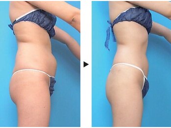 プリマプリート 名駅店