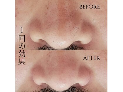 ユニ(uni.)の写真