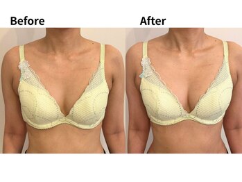 バストケア&アロマリンパセラピーnicco/