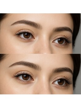 アート 宜野湾(THE ART)/LCカール・LDカール導入