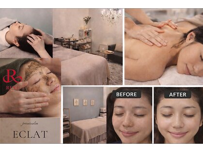 マイルーム(my room)の写真