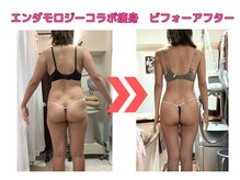 ソフィア ミューズ 目黒/エンダモロジー&サーモシェイプ