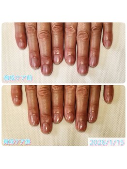 最強のネイルケア お試し体験